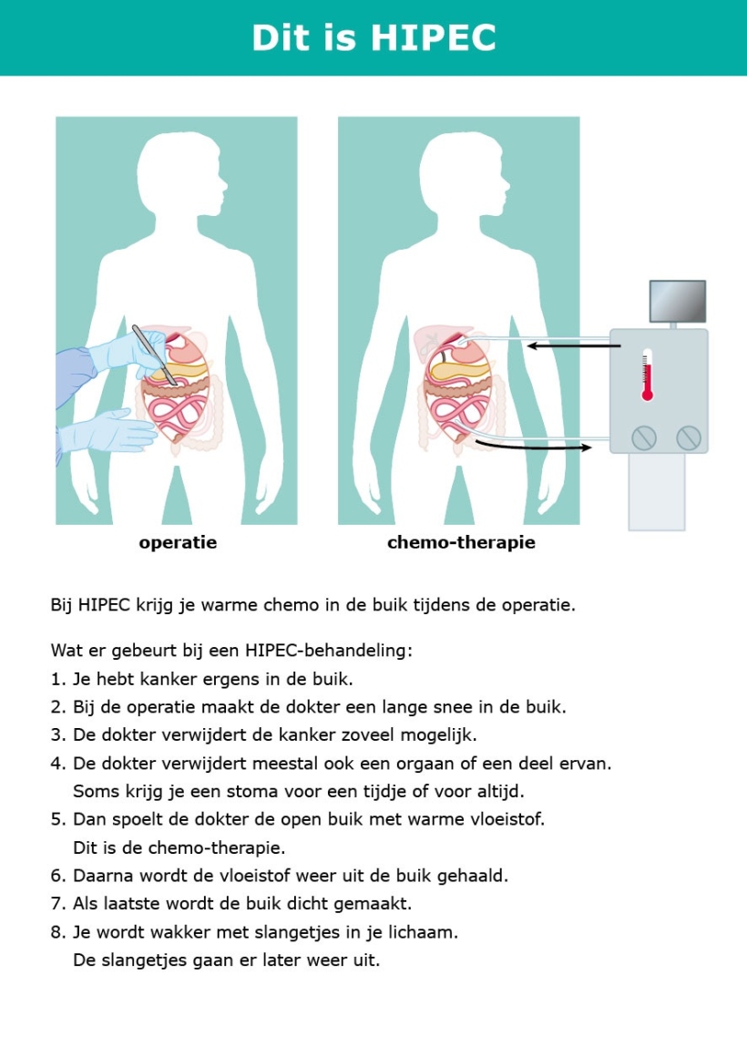 Praatkaart Dit is HIPEC afbeelding kant 1
