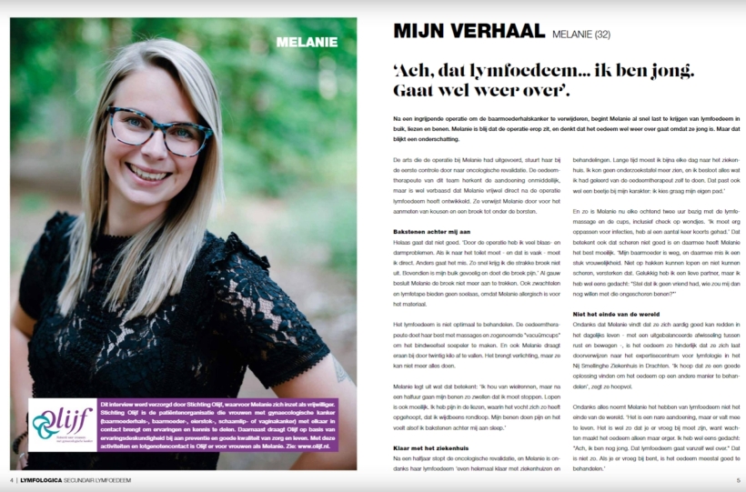 Melanie in magazine oedeem