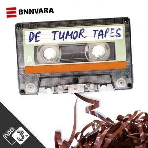 De tumor tapes